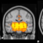 Imagen de la muestra de la actividad cerebral mientras se habla