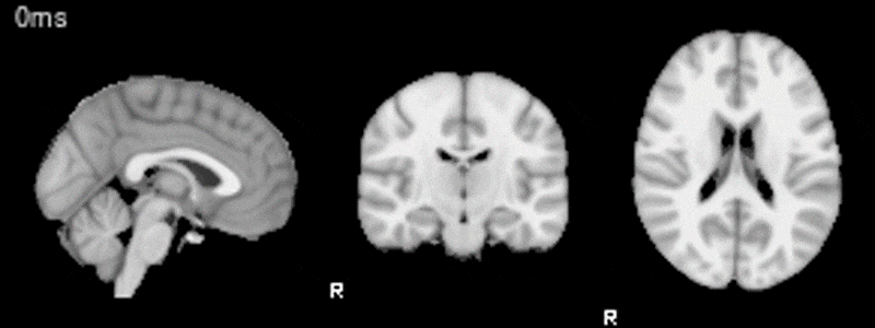 Una investigación de la ULL explica las razones profundas del habla y la  activación cerebral - ULL - Noticias