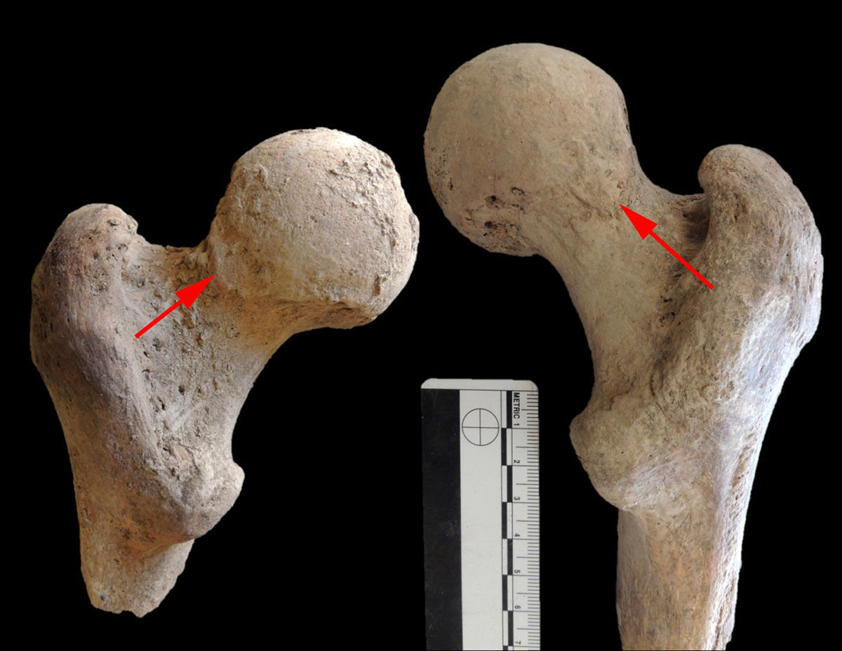 Dos fémures que presentan la llamada "faceta de Poirier", una adaptación del hueso debido al mantenimiento de una postura acuclillada, algo común en poblaciones antiguas con escaso o ningún mobiliario para sentarse.